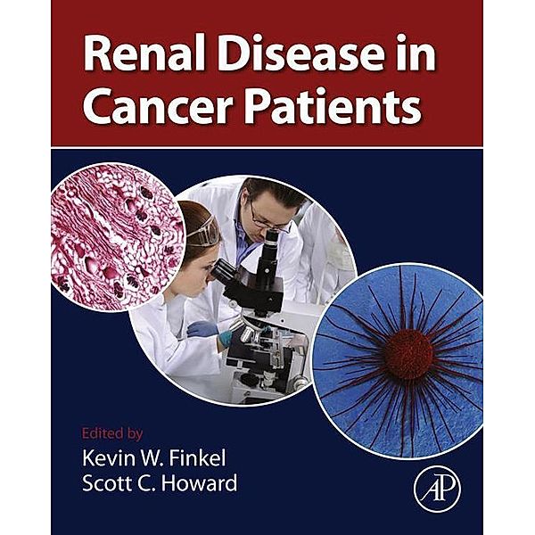 Renal Disease in Cancer Patients