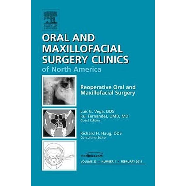 Reoperative Oral and Maxillofacial Surgery, An Issue of Oral and Maxillofacial Surgery Clinics, Rui Fernandes, Luis Vega