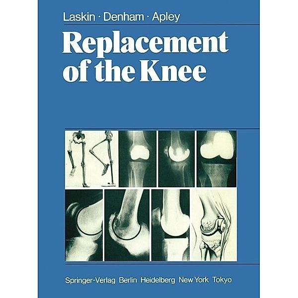 Replacement of the Knee, R. S. Laskin, R. A. Denham, A. G. Apley