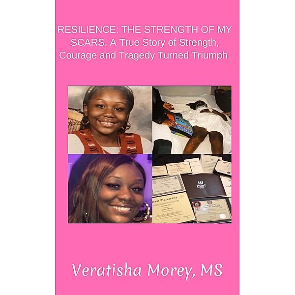 Resilience: The Strength of My Scars, a True Story of Strength, Courage and Tragedy Turned Triumph., Veratisha Morey