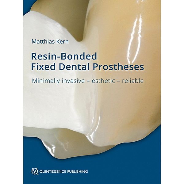 Resin-Bonded Fixed Dental Prostheses, Matthias Kern