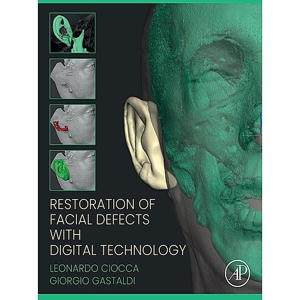 Restoration of Facial Defects with Digital Technology, Leonardo Ciocca, Giorgio Gastaldi