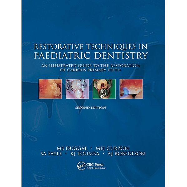 Restorative Techniques in Paediatric Dentistry, M. S. Duggal, M. E. J Cuzon, S. A. Fayle, K. J Toumba, A. J. Robertson