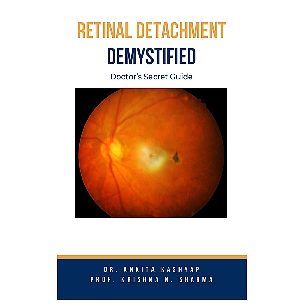 Retinal Detachment Demystified: Doctor's Secret Guide, Ankita Kashyap, Krishna N. Sharma