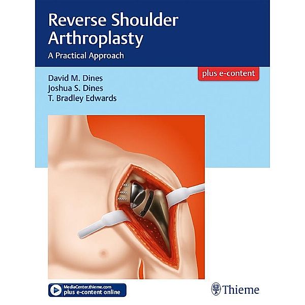 Reverse Shoulder Arthroplasty, David M. Dines, Joshua Dines, T Bradley Edwards