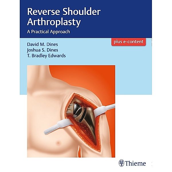Reverse Shoulder Arthroplasty, David M. Dines, Joshua Dines, T Bradley Edwards