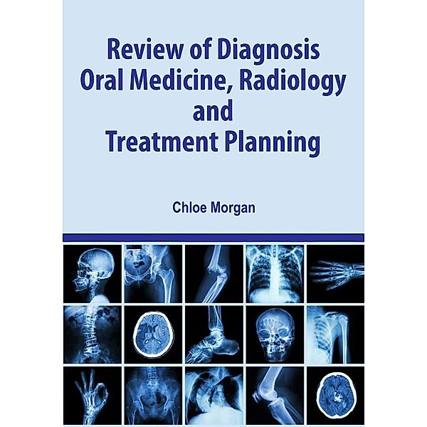 Review of Diagnosis, Oral Medicine, Radiology, and Treatment Planning, Cameron Grant