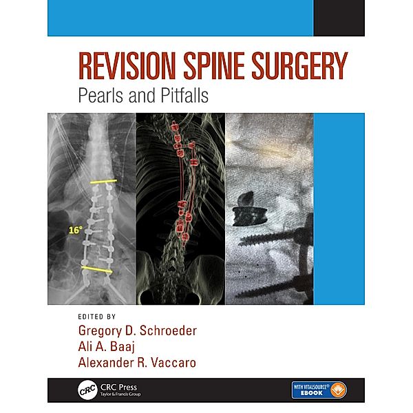 Revision Spine Surgery