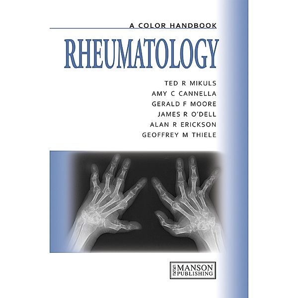 Rheumatology, Ted Mikuls, Amy Cannella, Gerald Moore, James O'Dell, Alan Erikson, Geoffrey Thiele