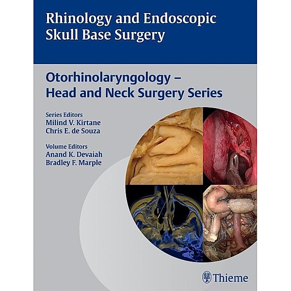 Rhinology and Endoscopic Skull Base Surgery