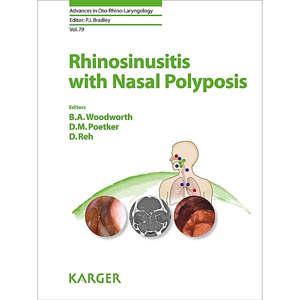 Rhinosinusitis with Nasal Polyposis