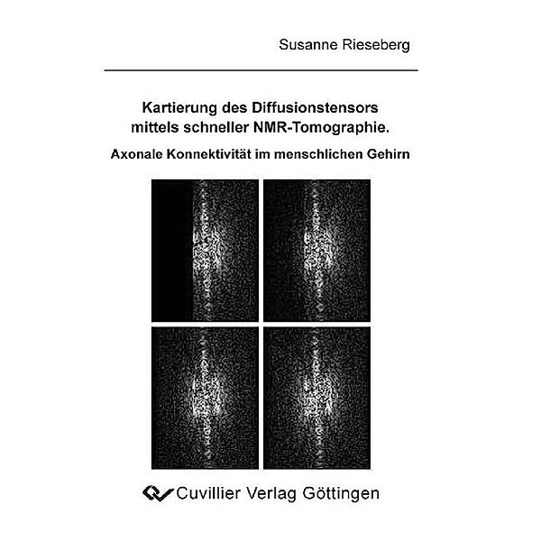 Rieseberg, S: Kartierung des Diffusionstensors mittels schne, Susanne Rieseberg