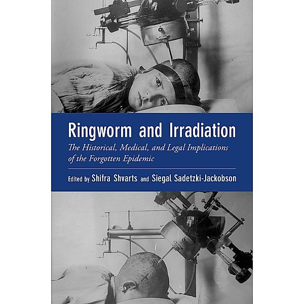 Ringworm and Irradiation, Shifra Shvarts, Siegal Sadetzki