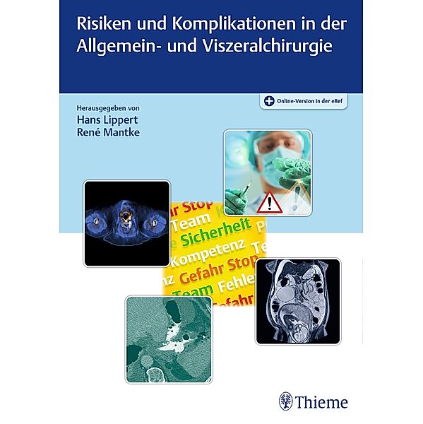 Risiken und Komplikationen in der Allgemein- und Viszeralchirurgie