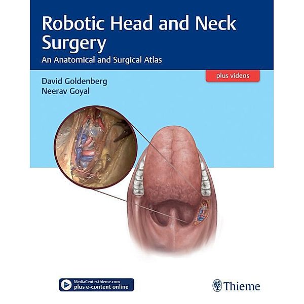 Robotic Head and Neck Surgery, David Goldenberg, Neerav Goyal