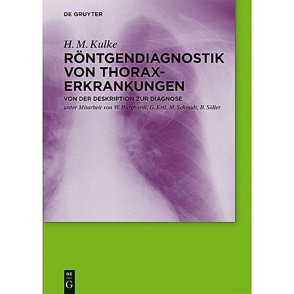 Röntgendiagnostik von Thoraxerkrankungen, H. M. Kulke