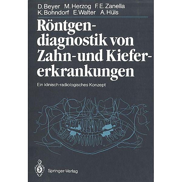 Röntgendiagnostik von Zahn- und Kiefererkrankungen, Dieter Beyer, Michael Herzog, Friedhelm Zanella, Klaus Bohndorf, Eberhard Walter, Alfons Hüls