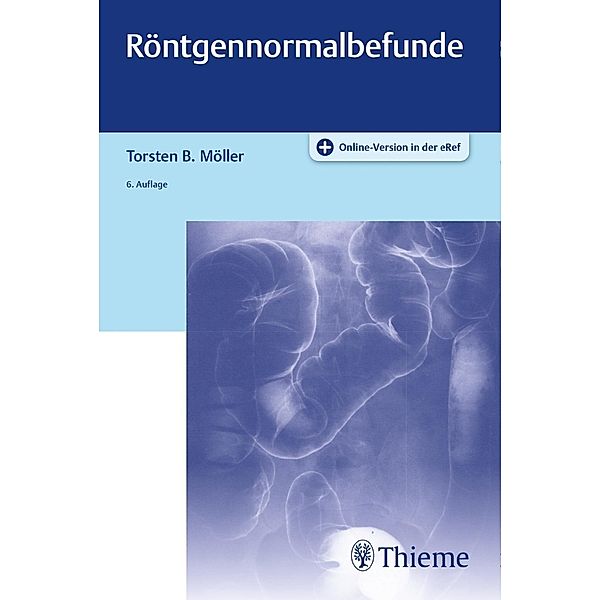 Röntgennormalbefunde, Torsten B. Möller