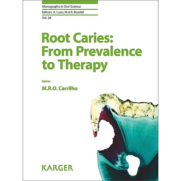 Root Caries: From Prevalence to Therapy