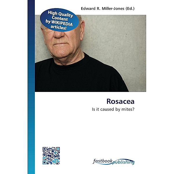 Rosacea