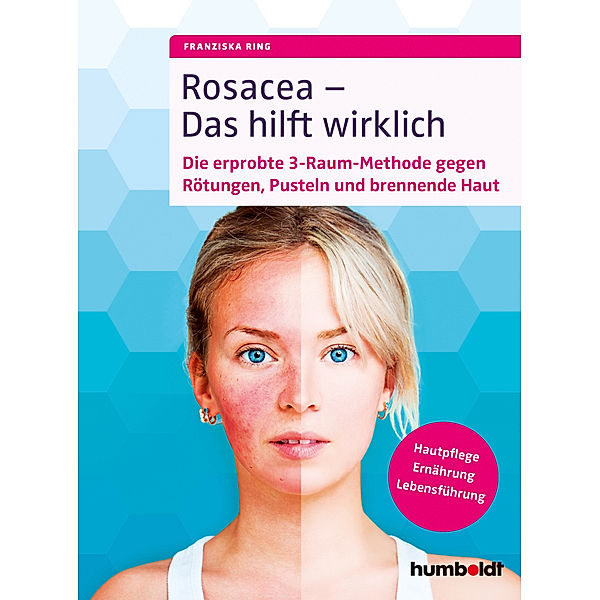 Rosacea - Das hilft wirklich, Franziska Ring