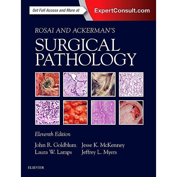 Rosai and Ackerman's Surgical Pathology - 2 Volume Set, John R. Goldblum, Laura W. Lamps, Jesse McKenney, Jeffrey L Myers