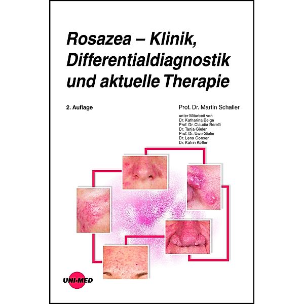 Rosazea - Klinik, Differentialdiagnostik und aktuelle Therapie / UNI-MED Science, Martin Schaller