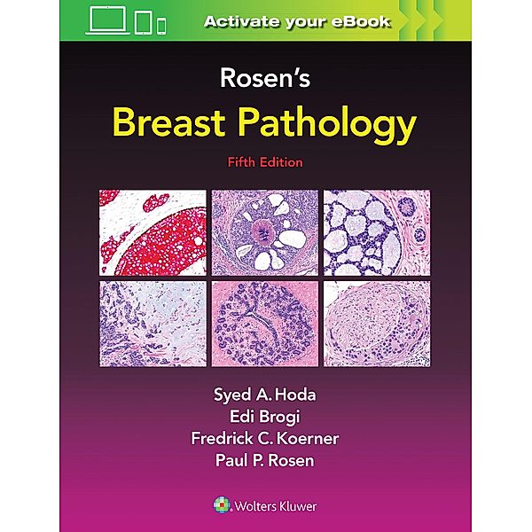 Rosen's Breast Pathology, Syed A. Hoda, Paul Peter, MD Rosen, Edi Brogi, Frederick C. Koerner