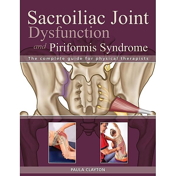 Sacroiliac Joint Dysfunction and Piriformis Syndrome, Paula Clayton