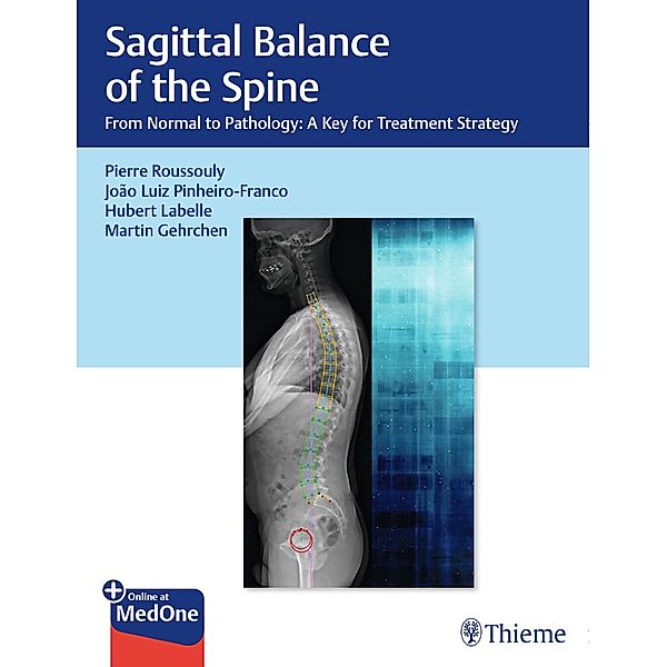 Sagittal Balance of the Spine