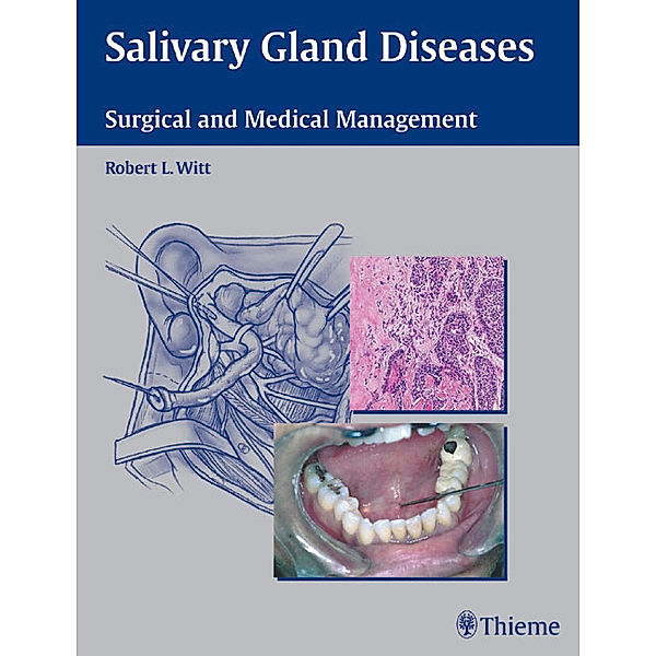 Salivary Gland Diseases, Robert L. Witt