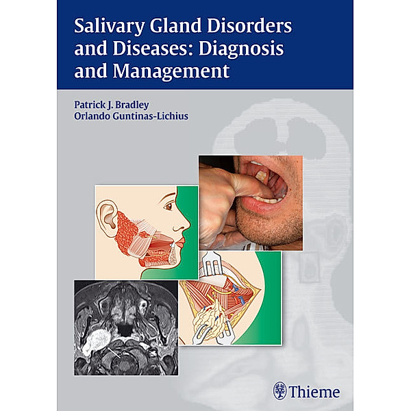 Salivary Gland Disorders and Diseases, Patrick J. Bradley, Orlando Guntinas-Lichius