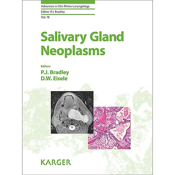 Salivary Gland Neoplasms