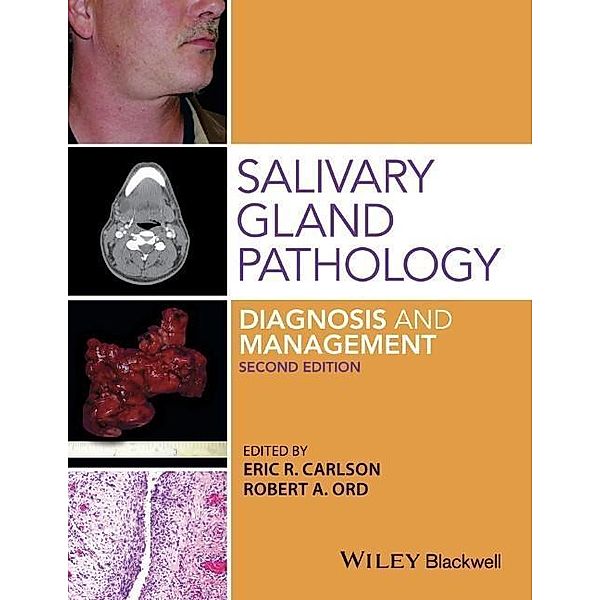 Salivary Gland Pathology, Eric R. Carlson, Robert A. Ord