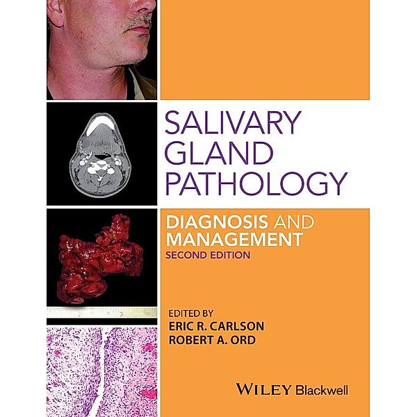Salivary Gland Pathology, Eric R. Carlson, Robert A. Ord