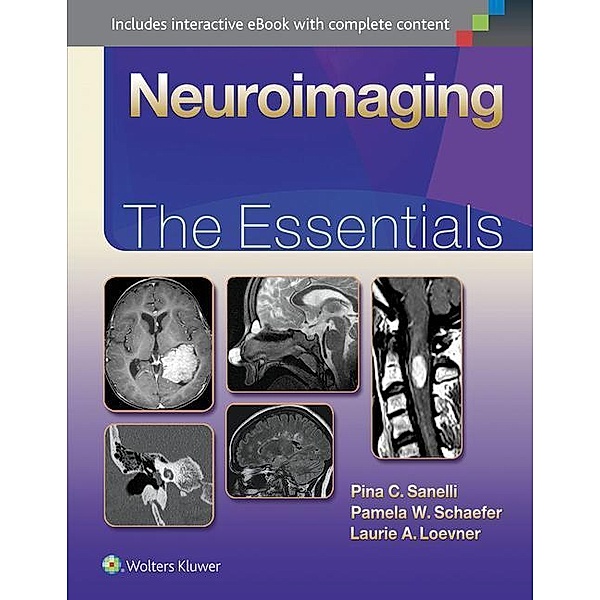 Sanelli, P: Neuroimaging, Pina C. Sanelli, Pamela W. Schaefer, Laurie A. Loevner