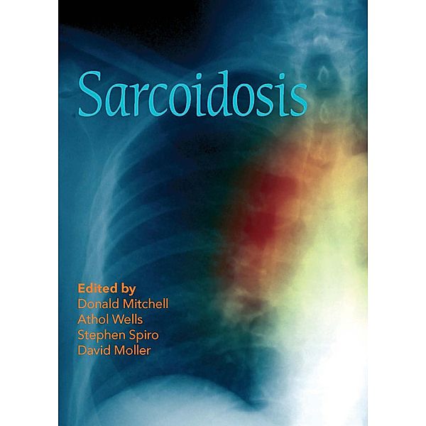 Sarcoidosis