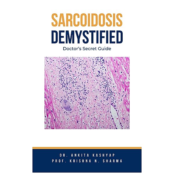 Sarcoidosis Demystified: Doctor's Secret Guide, Ankita Kashyap, Krishna N. Sharma
