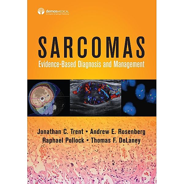 Sarcomas