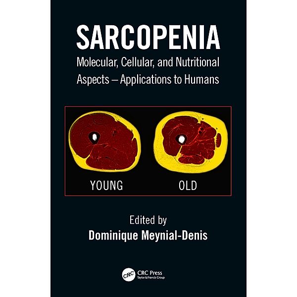 Sarcopenia