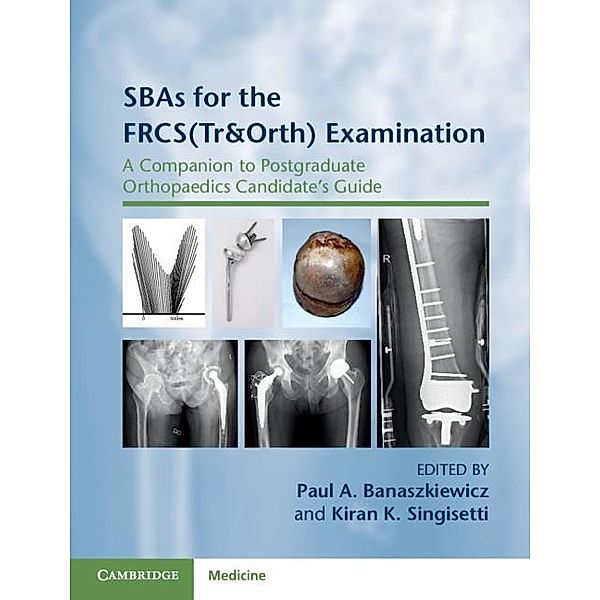 SBAs for the FRCS(Tr&Orth) Examination