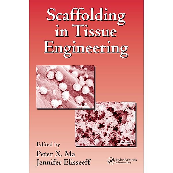 Scaffolding In Tissue Engineering