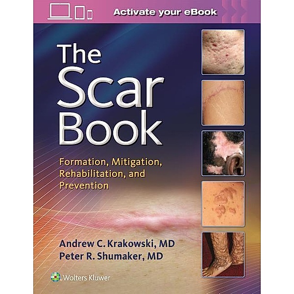 Scar Book Scar Form Rehab Prev CB: Formation, Mitigation, Rehabilitation and Prevention, Krakowski, Shumaker