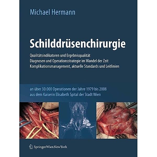 Schilddrüsenchirurgie - Qualitätsindikatoren und Ergebnisqualität, Diagnosen und Operationsstrategie im Wandel der Zeit, Komplikationsmanagement, aktuelle Standards und Leitlinien, Michael Hermann