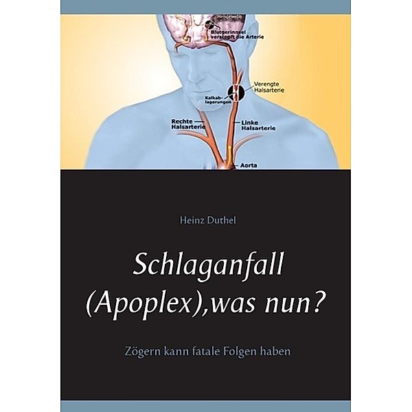 Schlaganfall (Apoplex), was nun?, Heinz Duthel