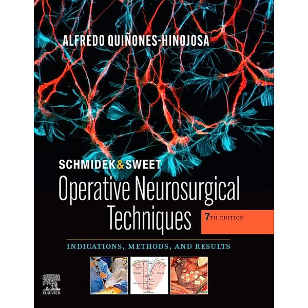 Schmidek and Sweet: Operative Neurosurgical Techniques E-Book, Alfredo Quinones-Hinojosa