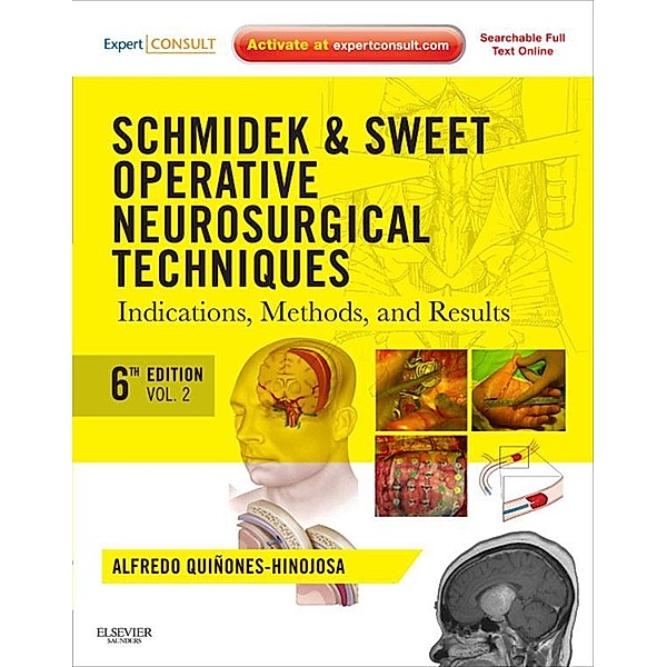 Schmidek and Sweet: Operative Neurosurgical Techniques E-Book, Alfredo Quinones-Hinojosa