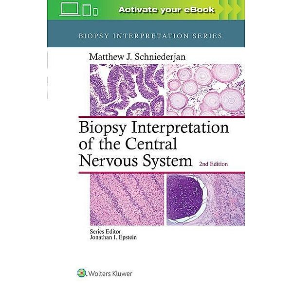 Schniederjan, M: Biopsy Central Nervous System, Matthew J. Schniederjan