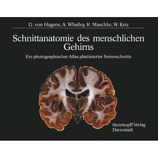 Schnittanatomie des menschlichen Gehirns, G. v. Hagens, A. Whalley, R. Maschke, W. Kriz