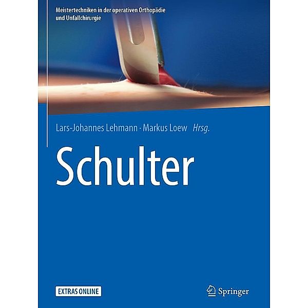 Schulter / Meistertechniken in der operativen Orthopädie und Unfallchirurgie